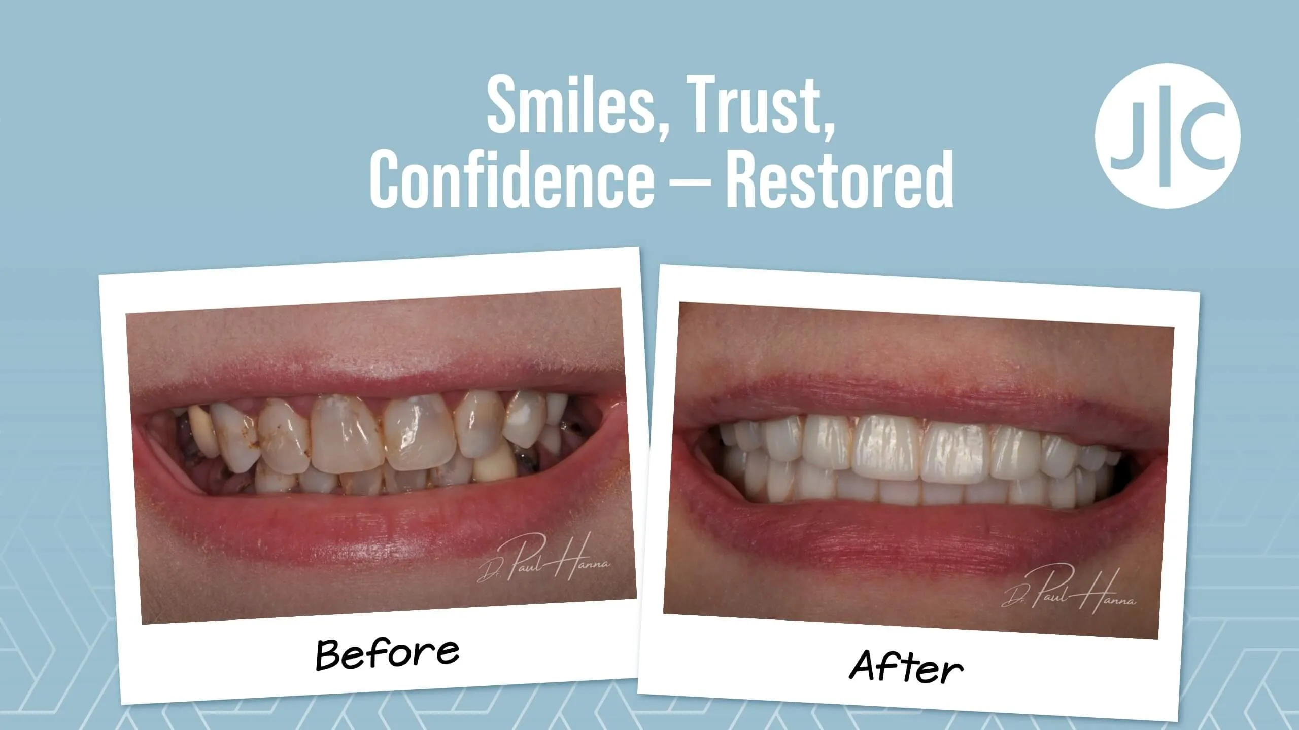 Cosmetic dentistry before and after